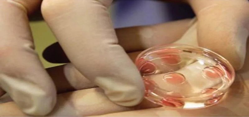 هل يتحقق حلم الأمومة المؤجل؟ ..   مشروع قانون يسمح للعازبات بتجميد البويضات.. !